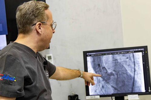 Sergipe realizou primeiro implante transcateter de válvula aórtica em paciente do SUS