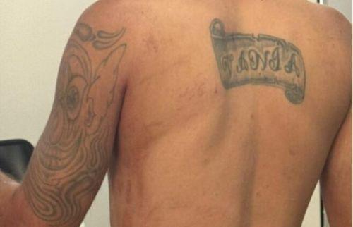 Homem fica ferido após ser atingido por golpe de tesoura durante briga em Campo do Brito